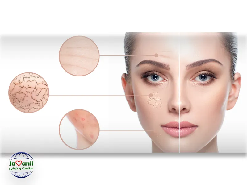 جوان سازی پوست صورت با روش طب سنتی ابن سینا